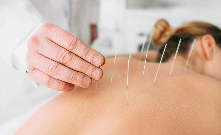 Acupuncture Could Assistance You Stop Cigarette smoking cigarettes