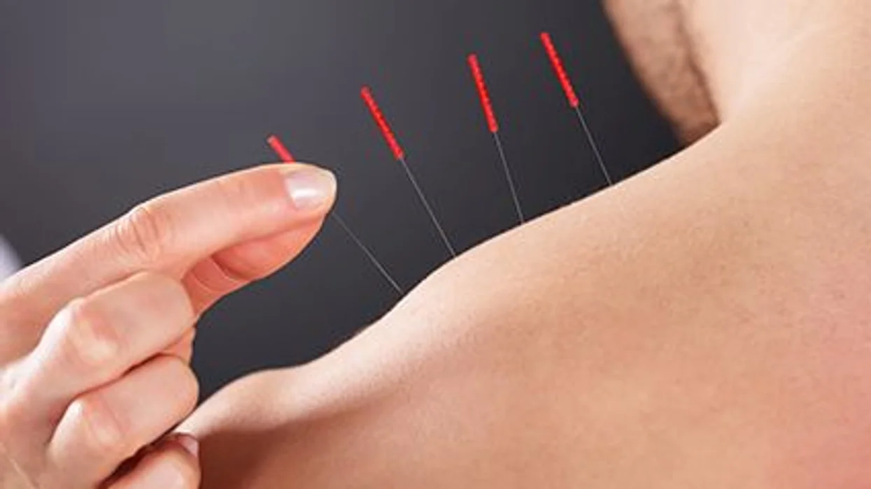 Acupuncture Carefully Disclosed
