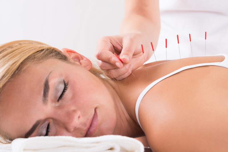 Acupuncture Could Assistance Deal with Migraines